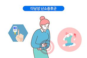다낭성 난소증후군