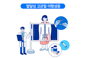 발달성 고관절 이형성증