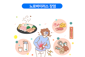 노로바이러스 장염